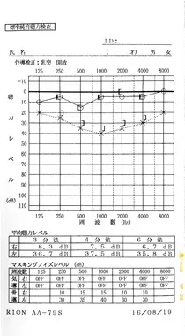 鍼治療で聴力が回復した血液循環の悪化が原因の左耳突発性難聴|治療後のオージオグラム