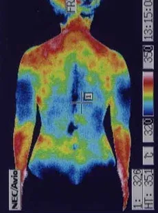 副腎の機能を整える鍼治療|治療後