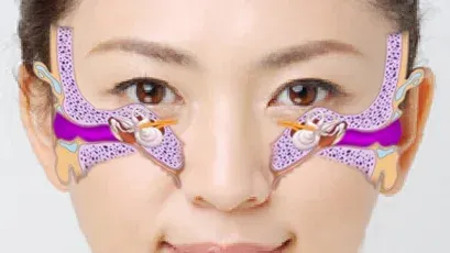 聴神経の場所を示した画像
