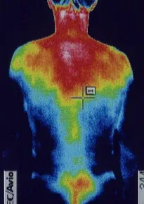 ウイルス感染が原因の左耳突発性難聴|サーモ画像