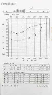 突発性難聴|発症時
