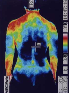 ストレスで低下した腰の血流