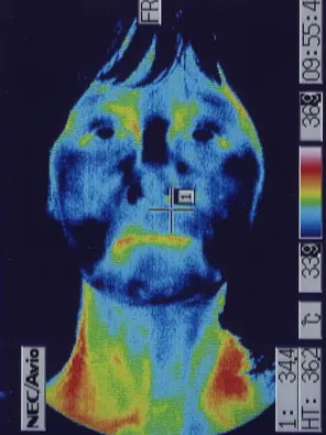サーモグラフィで顔の温度を調べる