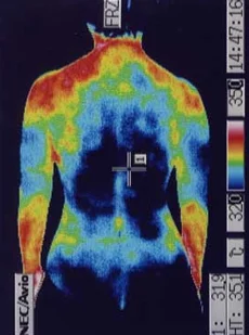 副腎の機能が低下した腰周囲の温度